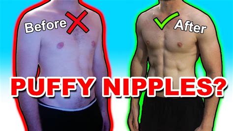 how to get rid of puffy nips